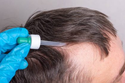 a-comprehensive-guide-to-hair-transplantation-at-nuhart-medical