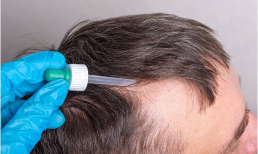 a-comprehensive-guide-to-hair-transplantation-at-nuhart-medical